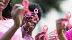 2nd Annual Charles Sims, MD Lecture - Reimagining a World without Breast Cancer: From Hype to Hope and Precision Health Care for ALL